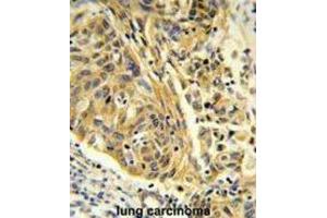 Immunohistochemistry (IHC) image for anti-Clathrin, Light Chain A (CLTA) antibody (ABIN3004002) (CLTA 抗体)