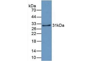Detection of Recombinant CRYl1, Human using Monoclonal Antibody to Crystallin Lambda 1 (CRYl1) (CRYL1 抗体  (AA 24-232))