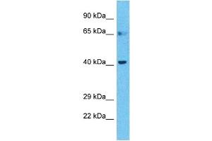 Host:  Rabbit  Target Name:  BTBD6  Sample Type:  Stomach Tumor lysates  Antibody Dilution:  1. (BTBD6 抗体  (C-Term))