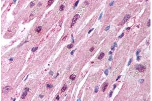 Human Heart (formalin-fixed, paraffin-embedded) stained with HUWE1 antibody ABIN213933 at 5 ug/ml followed by biotinylated goat anti-rabbit IgG secondary antibody ABIN481713, alkaline phosphatase-streptavidin and chromogen. (HUWE1 抗体  (C-Term))