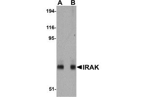 Western Blotting (WB) image for anti-Interleukin-1 Receptor-Associated Kinase 1 (IRAK1) (AA 618-712) antibody (ABIN492548) (IRAK1 抗体  (AA 618-712))