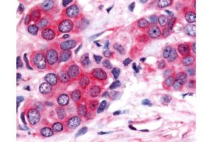 Immunohistochemistry (IHC) image for anti-Nuclear Receptor Subfamily 4, Group A, Member 3 (NR4A3) (Modulating Domain) antibody (ABIN1049140)