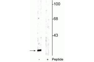 Western blot of rat cortical lysate showing specific immunolabeling of the ~15 kDa alpha synuclein protein phosphorylated at Ser129 in the first lane (-). (SNCA 抗体  (pSer129))