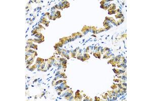 Immunohistochemistry of paraffin-embedded mouse lung using SERPINA10 antibody (ABIN5974273) at dilution of 1/100 (40x lens). (SERPINA10 抗体)