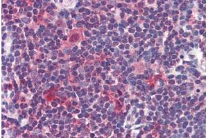Human Thymus: Formalin-Fixed, Paraffin-Embedded (FFPE) (Caspase 7 抗体  (C-Term))