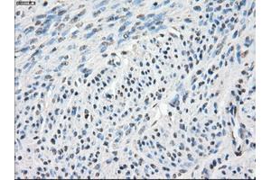 Immunohistochemical staining of paraffin-embedded endometrium tissue using anti-CA9mouse monoclonal antibody.