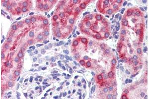 Mouse kidney: Formalin-Fixed, Paraffin-Embedded (FFPE) (IFIH1 抗体  (C-Term))