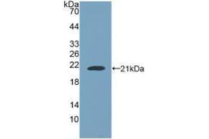 Western blot analysis of recombinant Human NUP210. (NUP210 抗体  (AA 1288-1449))