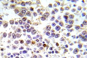Immunohistochemistry (IHC) analyzes of p-Histone H3. (Histone H3.1 抗体  (pSer10))