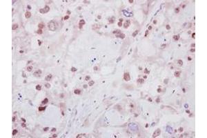 Image no. 1 for anti-IKAROS Family Zinc Finger 2 (IKZF2) (AA 263-504) antibody (ABIN1498849) (IKZF2 抗体  (AA 263-504))