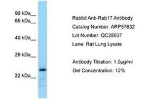 Image no. 1 for anti-RAB17, Member RAS Oncogene Family (RAB17) (AA 121-170) antibody (ABIN6749942) (RAB17 抗体  (AA 121-170))