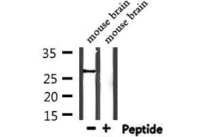 Western Blotting (WB) image for anti-Proteasome Subunit alpha Type 1 (PSMA1) (C-Term) antibody (ABIN6264468)