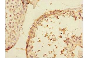 Immunohistochemistry of paraffin-embedded human testis tissue using ABIN7174506 at dilution of 1:100 (UBE2Z 抗体  (AA 115-354))