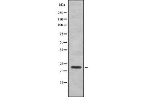 Western blot analysis SAP30 using 293 whole cell lysates (SAP30 抗体  (Internal Region))