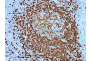 Formalin-fixed, paraffin-embedded human Lymph Node stained with TCL1 Mouse Monoclonal Antibody (TCL1/2079). (TCL1A 抗体  (AA 2-109))