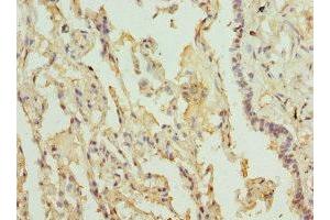 Immunohistochemistry of paraffin-embedded human lung tissue using ABIN7158277 at dilution of 1:100 (LILRB4 抗体  (AA 22-259))