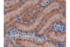 DAB staining on IHC-P; Samples: Mouse Kidney Tissue (JAK3 抗体  (AA 517-749))