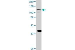 ADAMTS17 monoclonal antibody (M01), clone 3B7.
