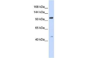 TRPC4 antibody used at 1 ug/ml to detect target protein. (TRPC4 抗体  (Middle Region))