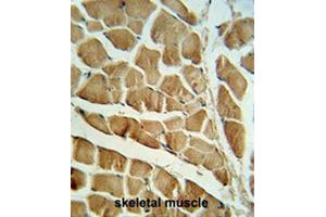 CAPN3 Antibody (C-term) IHC analysis in formalin fixed and paraffin embedded skeletal muscle followed by peroxidase conjugation of the secondary antibody and DAB staining. (Calpain 3 抗体  (C-Term))