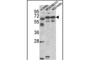 Western blot analysis of Fascin-3 Antibody (N-term) (ABIN390722 and ABIN2840998) in MDA-M, NCI- cell line and mouse testis tissue lysates (35 μg/lane). (Fascin 3 抗体  (N-Term))