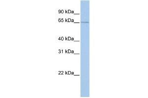 WB Suggested Anti-GPR161 Antibody Titration:  0. (GPR161 抗体  (Middle Region))