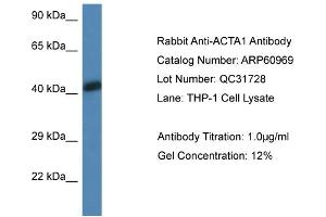 Western Blotting (WB) image for anti-Actin, alpha 1, Skeletal Muscle (ACTA1) (N-Term) antibody (ABIN2788636) (Actin 抗体  (N-Term))