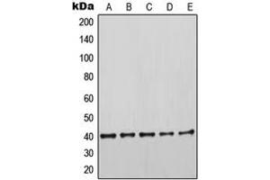 Western blot analysis of Cytokeratin 19 expression in HeLa (A), MCF7 (B), SKBR3 (C), MDAMB435 (D), HEK293T (E) whole cell lysates. (Cytokeratin 19 抗体  (Center))