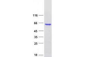 Western Blotting (WB) image for Oxidative Stress Induced Growth Inhibitor 1 (OSGIN1) (Transcript Variant 1) protein (Myc-DYKDDDDK Tag) (ABIN2728069)