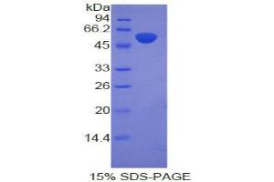 SDS-PAGE analysis of Rat Adrenocorticotropic Hormone Protein. (POMC 蛋白)
