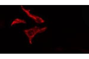 ABIN6278571 staining  HT29 cells by IF/ICC. (FZD7 抗体  (C-Term))