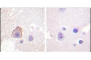 Immunohistochemistry analysis of paraffin-embedded human brain tissue, using ADD1 (Ab-726) Antibody. (alpha Adducin 抗体  (AA 688-737))