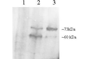 Western Blotting (WB) image for anti-Proprotein Convertase Subtilisin/kexin Type 9 (PCSK9) (AA 679-692) antibody (ABIN296977) (PCSK9 抗体  (AA 679-692))