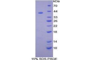 SDS-PAGE analysis of Rat Syndecan 1 Protein. (Syndecan 1 Protein (SDC1))
