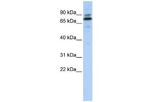 C14ORF21 antibody used at 1 ug/ml to detect target protein. (C14orf21 抗体  (Middle Region))