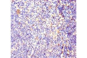 Immunohistochemistry of paraffin-embedded human lymphoid tissue using ABIN7170927 at dilution of 1:100 (OXCT1 抗体  (AA 40-520))