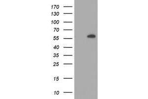 Western Blotting (WB) image for anti-V-Akt Murine Thymoma Viral Oncogene Homolog 1 (AKT1) antibody (ABIN1496554) (AKT1 抗体)