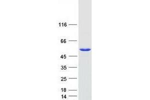 Western Blotting (WB) image for tyrosyl-DNA phosphodiesterase 2 (TDP2) protein (Myc-DYKDDDDK Tag) (ABIN2734530)