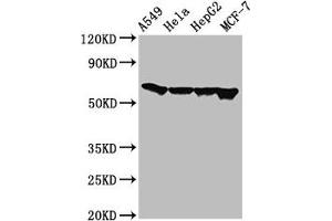 Western Blot Positive WB detected in: A549 whole cell lysate, Hela whole cell lysate, HepG2 whole cell lysate, MCF-7 whole cell lysate All lanes: FZD10 antibody at 3 μg/mL Secondary Goat polyclonal to rabbit IgG at 1/50000 dilution Predicted band size: 66 kDa Observed band size: 66 kDa (FZD1 抗体  (AA 125-225))