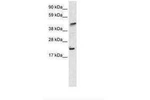 Image no. 1 for anti-IKAROS Family Zinc Finger 5 (Pegasus) (IKZF5) (N-Term) antibody (ABIN6735950) (IKZF5 抗体  (N-Term))