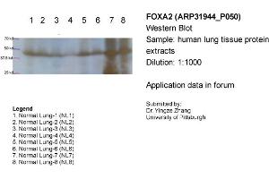 Sample Type: Human lung tissue protein extractsPrimary Dilution: 1:1000Secondary (Anti-Rabbit HRP sc-2004) Dilution: 1:1000 (FOXA2 抗体  (Middle Region))