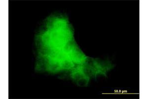 Immunofluorescence of monoclonal antibody to S100A7 on A-431 cell.