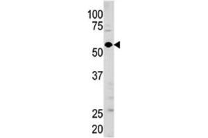 Western Blotting (WB) image for anti-Guanylate Cyclase 1 Soluble Subunit Alpha (GUCY1A1) antibody (ABIN3003008) (GUCY1A1 抗体)