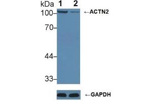 Western blot analysis of (1) Wild-type HeLa cell lysate, and (2) ACTN2 knockout HeLa cell lysate, using Rabbit Anti-Mouse ACTN2 Antibody (1 µg/ml) and HRP-conjugated Goat Anti-Mouse antibody ( (ACTN2 抗体  (AA 1-254))