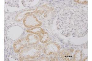 Immunoperoxidase of monoclonal antibody to PI15 on formalin-fixed paraffin-embedded human kidney. (PI15 抗体  (AA 18-117))