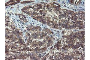 Image no. 3 for anti-Crystallin, Zeta, Homolog antibody (ABIN1497658) (CRYZL1 抗体)