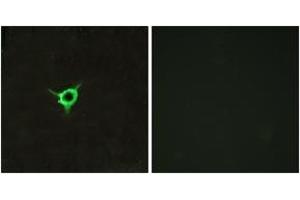 Immunofluorescence analysis of LOVO cells, using CNR1 Antibody. (CNR1 抗体  (AA 151-200))