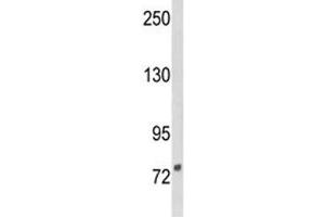 Western blot analysis of DGCR8 antibody and NCI-H460 lysate. (DGCR8 抗体  (AA 439-466))