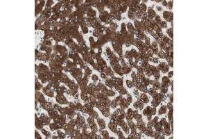 Immunohistochemical staining (Formalin-fixed paraffin-embedded sections) of human liver shows strong cytoplasmic positivity in hepatocytes. (Glucose-6-Phosphate Dehydrogenase 抗体  (AA 43-154))