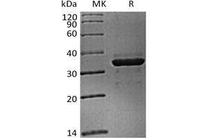 Western Blotting (WB) image for Fibrinogen-Like 1 (FGL1) (Active) protein (His tag) (ABIN7321019)